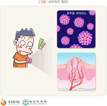�縶���� ����