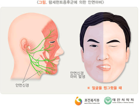 �ȸ鸶��