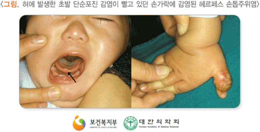 �츣�佺 ����